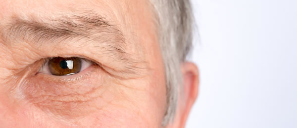 Cataract Surgery